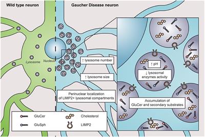 Neuronopathic Gaucher disease: Beyond lysosomal dysfunction